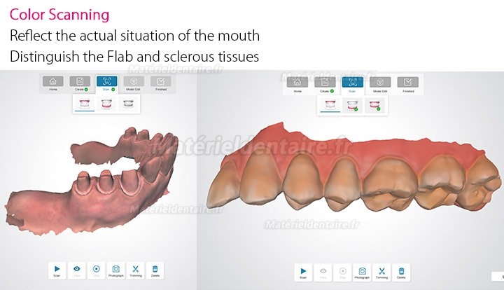 Scanner intraoral numérique dentaire 3D Fussen